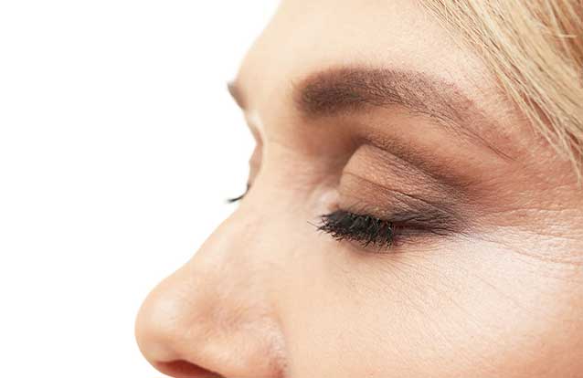 Woman needing Exilis on eye area in Fremont