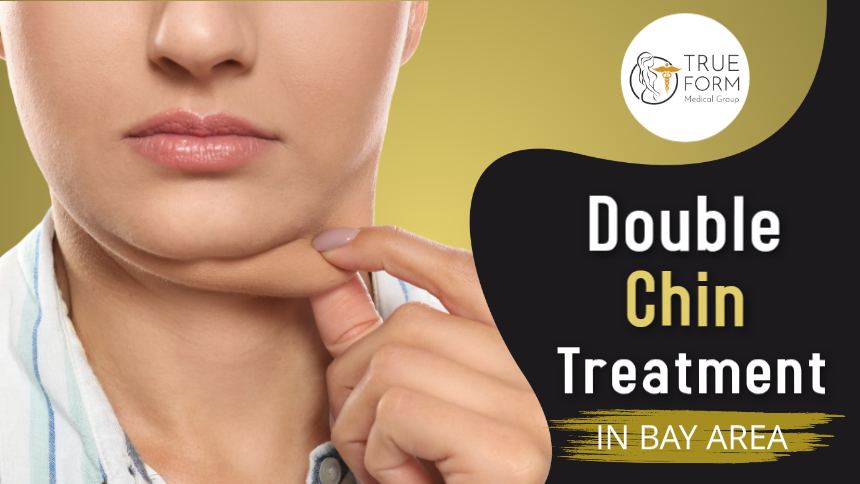 Double Chin Treatment in Fremont