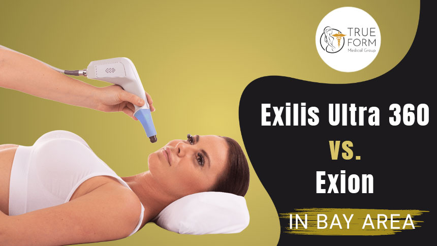 Exilis Ultra 360 vs Exion in Fremont
