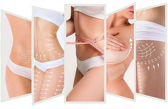 body sculpting trends in Fremont