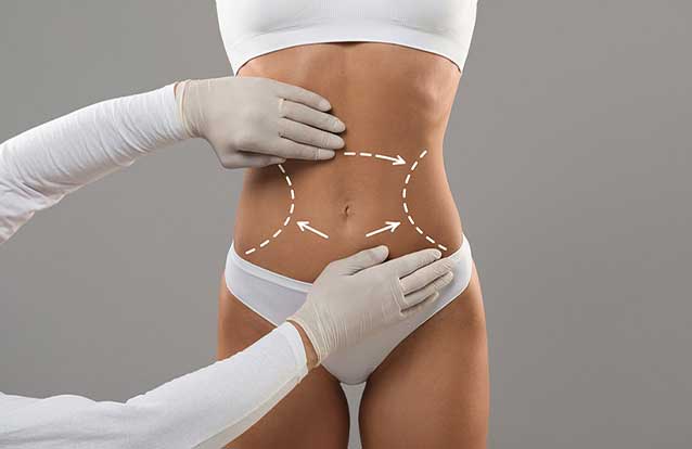 Body sculpting treatment in Fremont