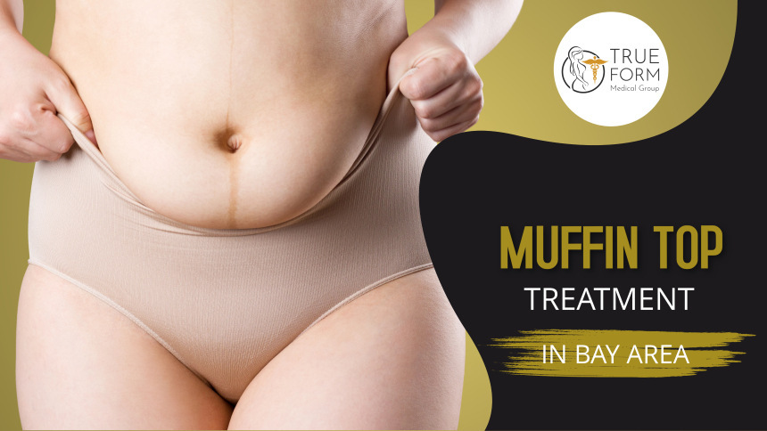 muffin top treatment in Fremont